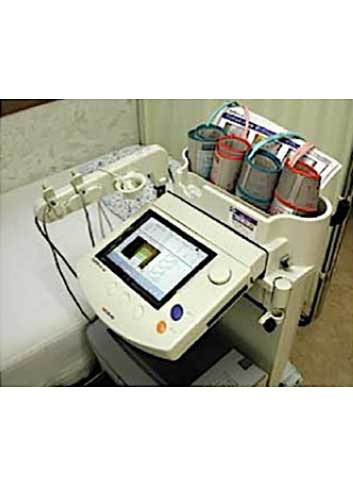 血圧脈波検査装置(CAVI)
