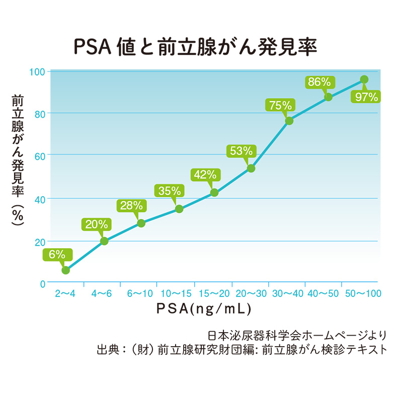 進化する前立腺がんの検査と治療法