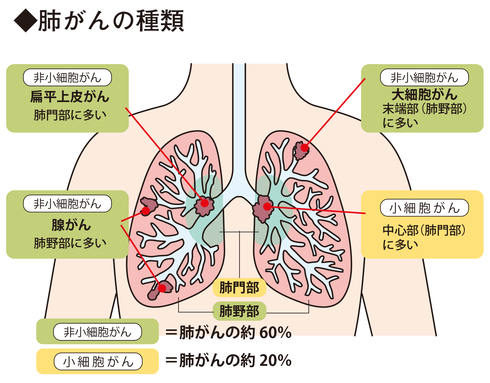 各科連携で最新の肺がん治療を提供