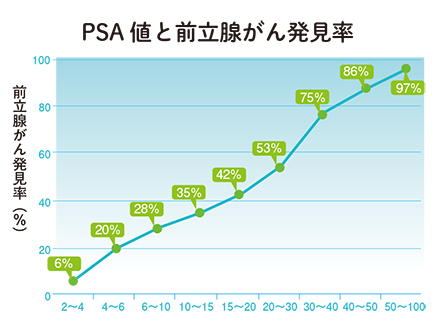 進化する前立腺がんの検査と治療法