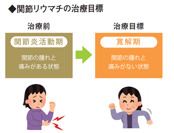 関節リウマチの治療目標