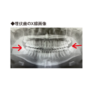 見逃せない口の中の病気を専門治療で治す