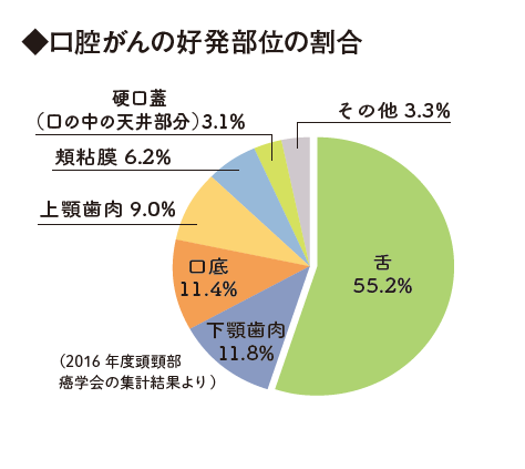 口腔がんの好発部位